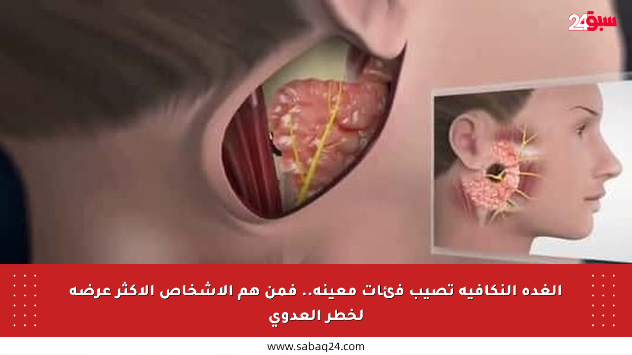 الغدة النكافية تصيب فئات معينة.. فمن هم الأشخاص الأكثر عرضة لخطر العدوى